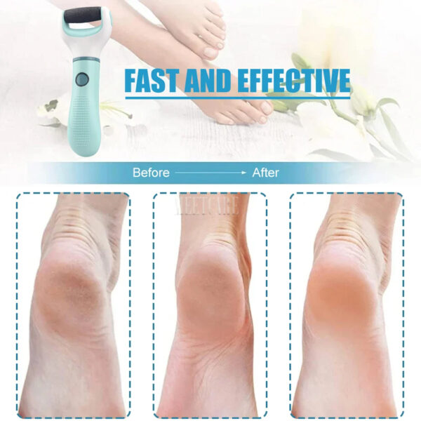 Foot care tool fast and effective