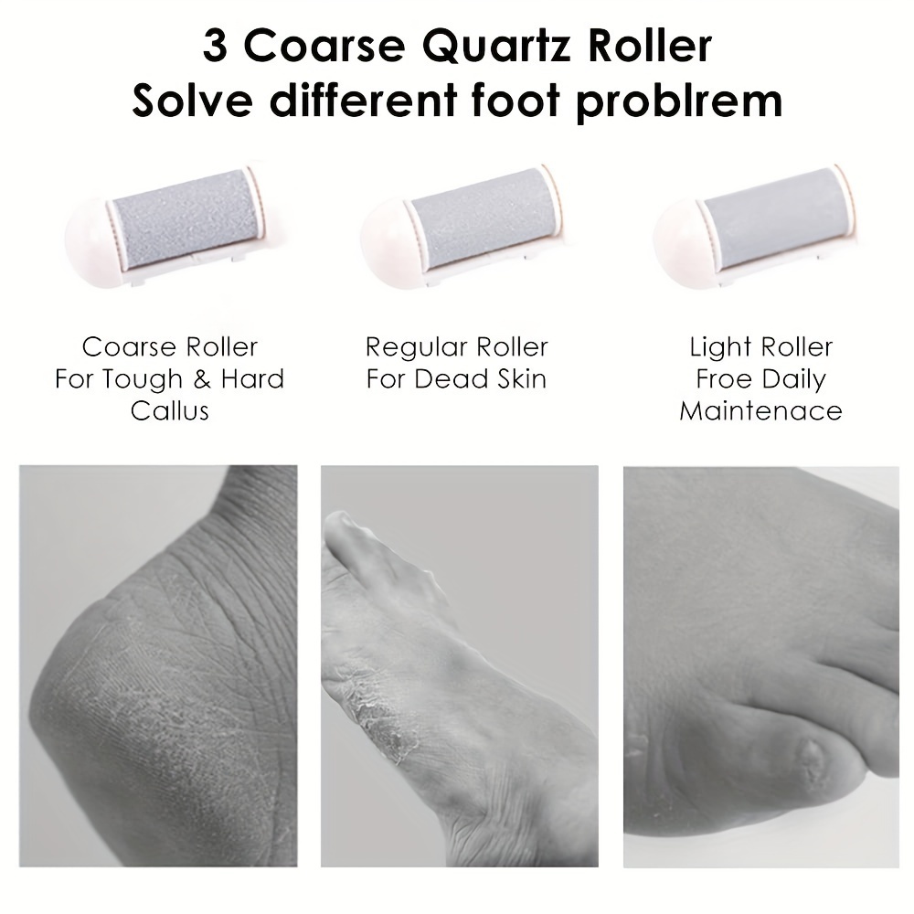 Interchangeable quartz sand rollers for different foot conditions