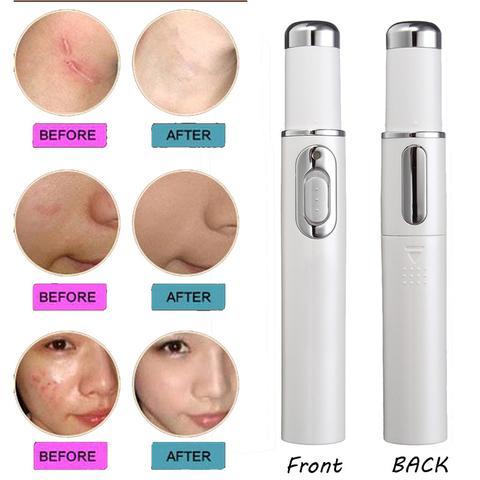 Multi-use skin therapy pen for removing spider veins and acne scars