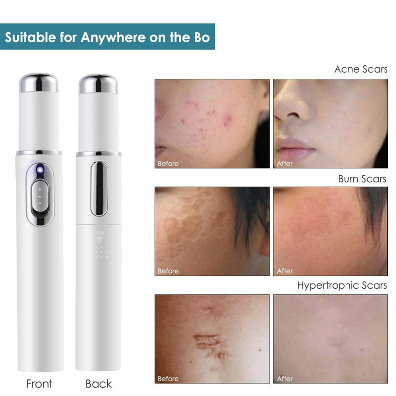 Blue light tool to reduce pimples, acne scars, and redness