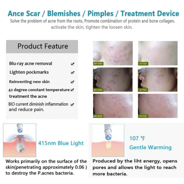 Blue light skincare device for glowing, even-toned skin