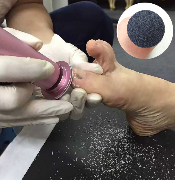 Professional electric foot file for dry skin and calluses